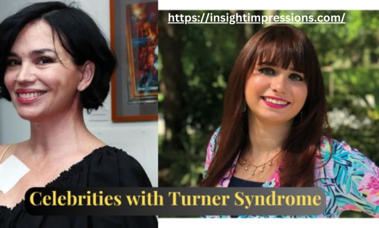 Celebrities with Turner Syndrome