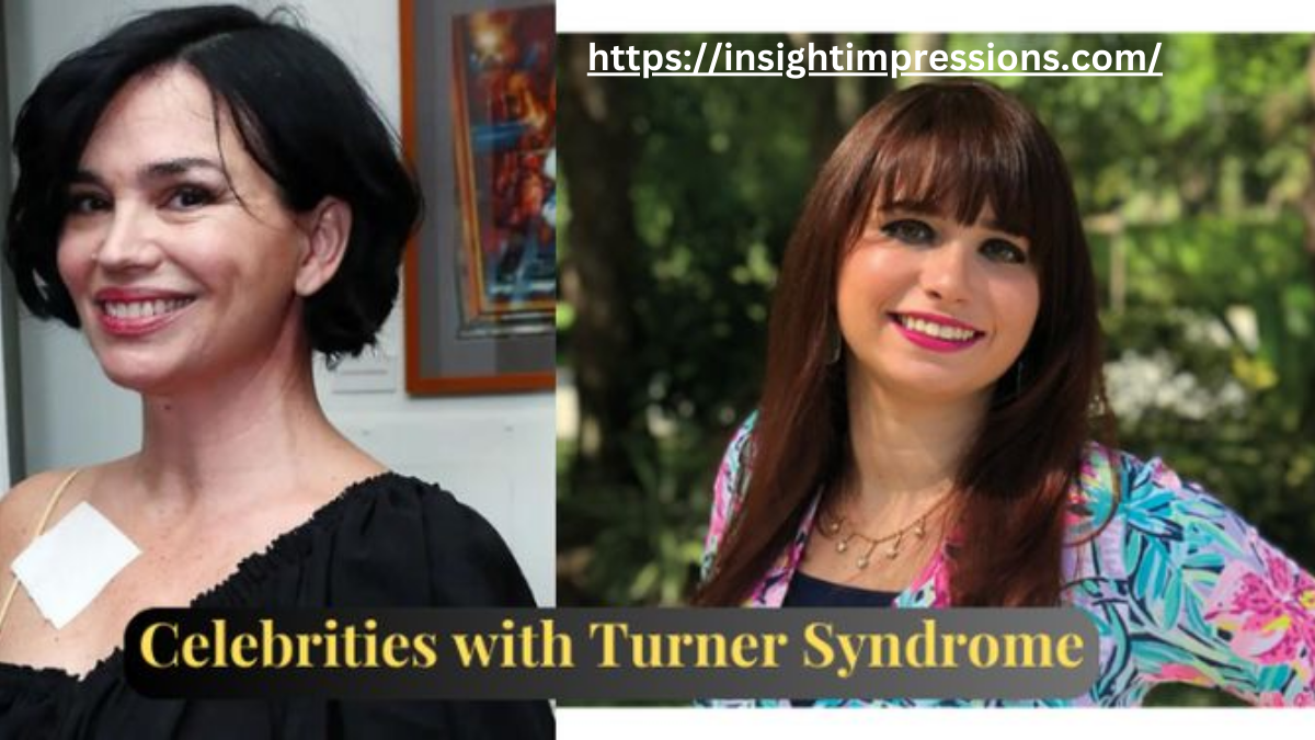 Celebrities with Turner Syndrome